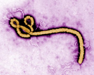 4 reasons Ebola has been underestimated 